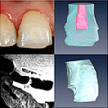 MRI in caryology