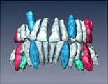 MRI in orthodontics