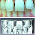 MRI in prosthodontics