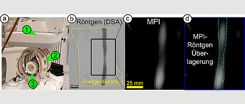 Der iMPI-Scanner (links) ermöglicht neue Einblicke in den menschlichen Körper. Hier zu sehen ist eine Engstelle in einem Blutgefäß – aufgenommen mit konventionellen Röntgenstrahlen (b), mit dem Scanner (c) und in einer Kombination beider Techniken (d).