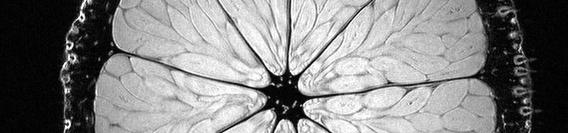 MRI of a lime