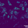 06 June - fluorescence microscopy image of Chinese hamster ovary cells marked with a chromophore  